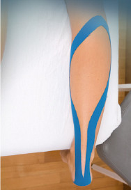 Achillessehne_2 Achillessehne_2