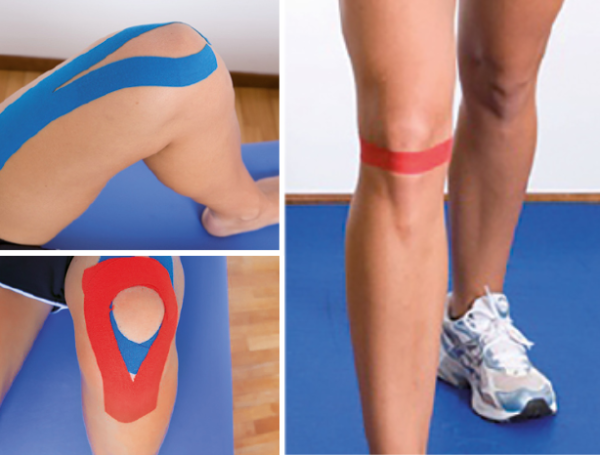 taping-kniegelenk taping-kniegelenk